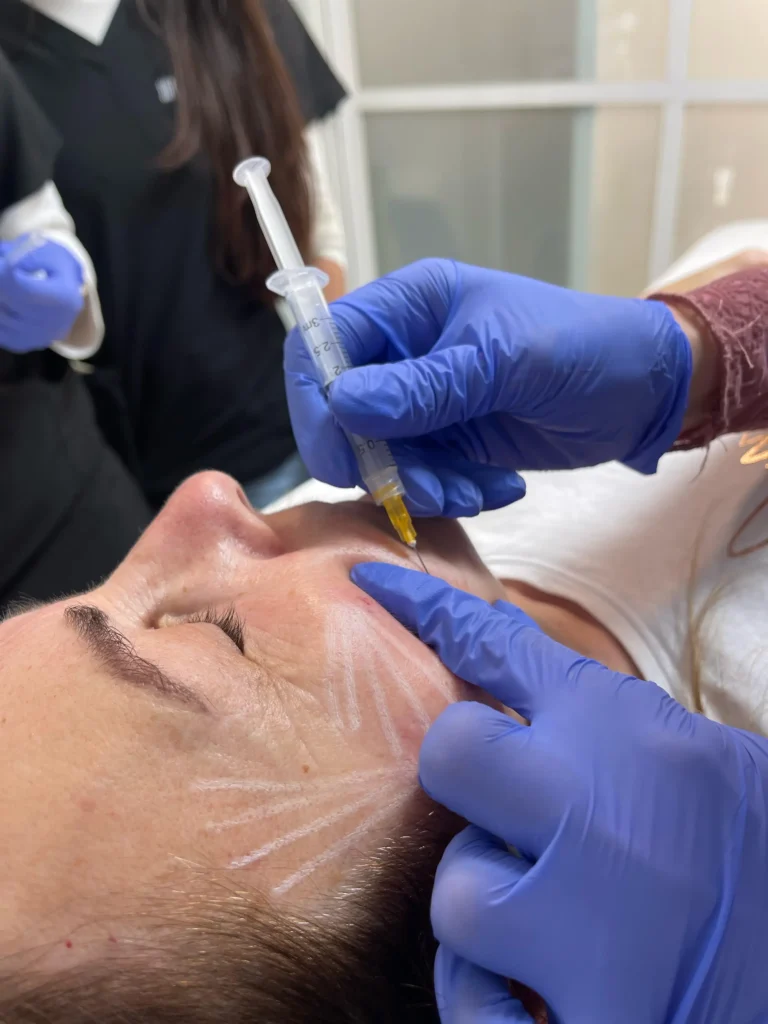 Sculptra TRAMIENTO FACIAL EN MALAGA